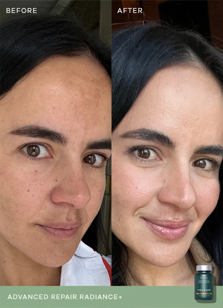 Vida Glow Radiance 