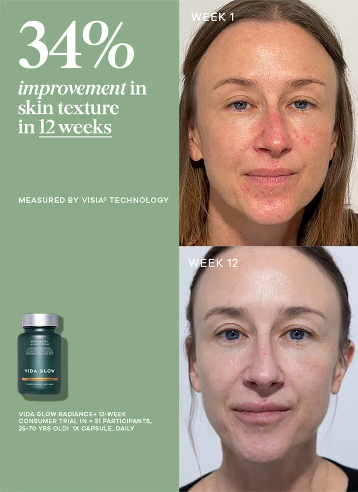 Vida Glow Radiance 